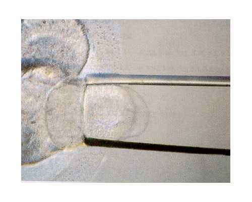 云南靠谱代孕价格|广西三代试管助孕机构，广西三代试管助孕机构名单