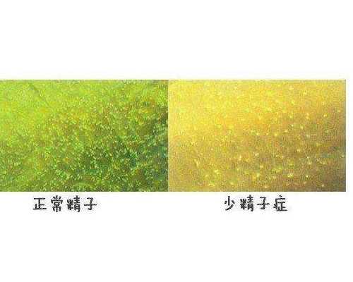 昆明去哪里找代孕女_男性精子残片率高,赴美国做试管婴儿要做第几代