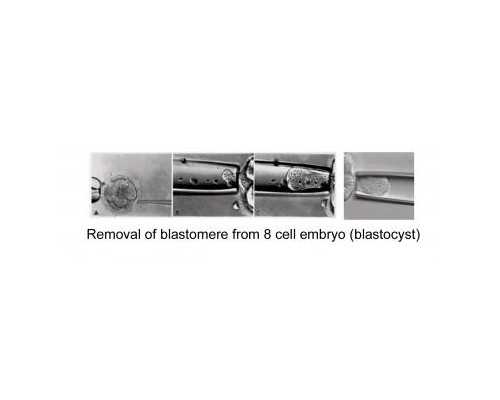 昆明三代试管pgd代孕,2024
珠海试管助孕医院哪家好-北医三院试管检查有效期_江