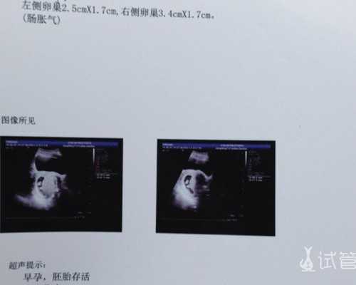 昆明做供卵三代多少钱,昆明一代试管和二代三代试管的区别,昆明试管婴儿价