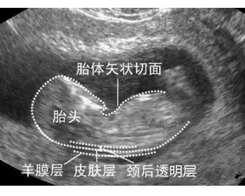 云南权威代孕网|南宁做供卵试管婴儿多少钱，广西供卵试管助孕费用影响因素