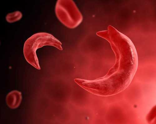 耳垂畸形有哪几种类型