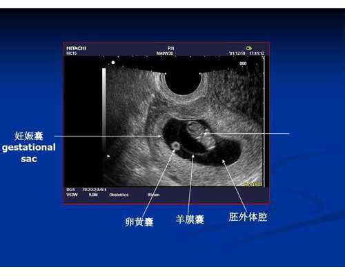 昆明助孕双胞胎包成功多少钱_2023德阳可以做三代试管生男孩吗?大概多少钱?