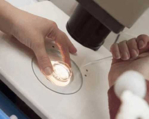 昆明寻代孕女 昆明昆华医院做第三代试管婴儿的流程 ‘b超如何测男女’