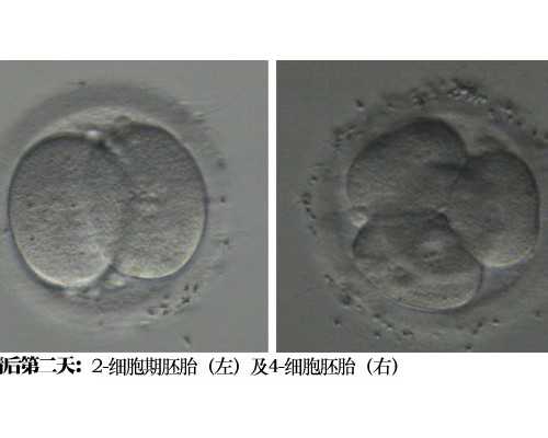 云南代怀试管费用|2023
云南三代试管婴儿医院排名,附三代试管生男孩医院推荐