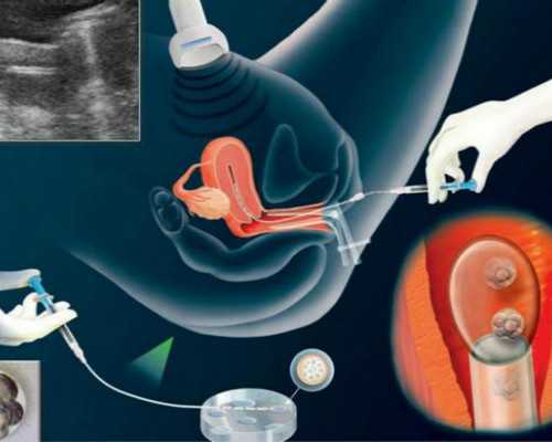 云南包成功代怀孕|石家庄市第一医院试管婴儿日记，2023助孕成功率与费用估算