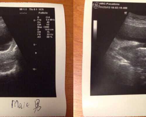 云南代怀多少费用|晋城三代试管费用三代试管费用是多少haoyunbang