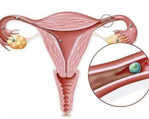 昆明供卵借卵助孕医院,昆明三代试管费用明细_昆明3代试管