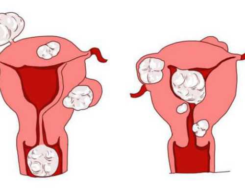 昆明安琪儿试管婴儿费用明细表，2023
助孕过程花费预估