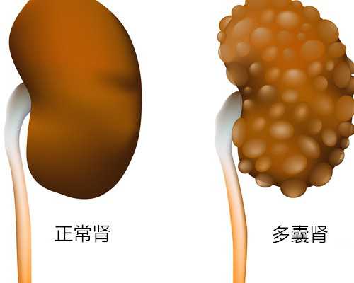 厦门洗精 厦门试管婴儿生男孩安全吗？试管婴儿怎样才能生男孩？ ‘b超2.2*1