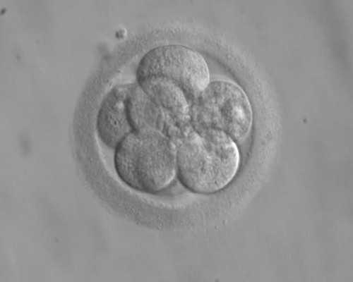 云南高龄供卵|金华哪里可以做试管,女方取卵有哪些注意事项?