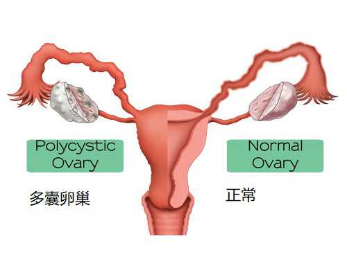 昆明代孕需要花多少钱_做试管婴儿取卵危害大吗