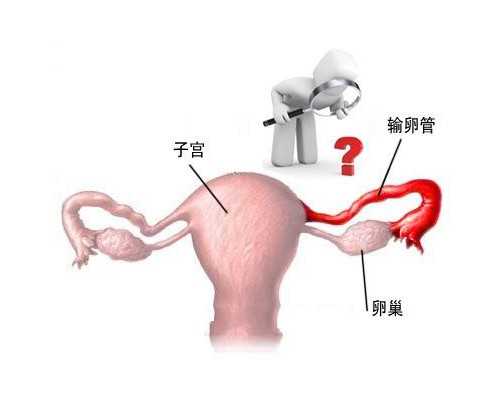 昆明代怀花费 昆明市试管婴儿医生排名去哪儿找?哪里的医生比较好? ‘孕囊