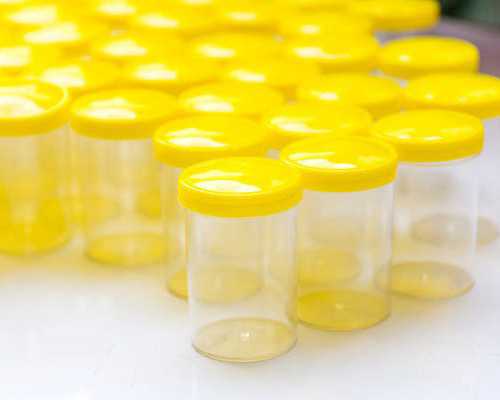 昆明卵巢早衰供卵助孕流程,排卵正常做试管有必要促排吗?还要打促排针吗?