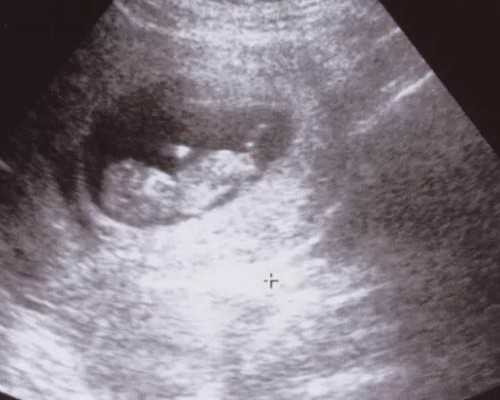 昆明昆华医院试管婴儿,昆明昆华医院在线咨询