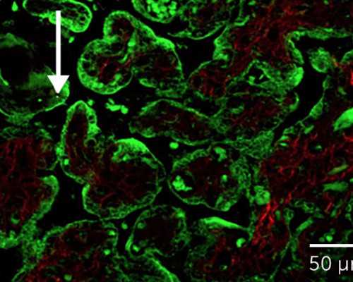 成都什么庙求子比较灵?怎样才能快速怀上孩子?