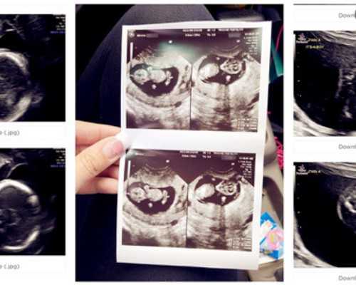 云南试管三代供卵|石家庄胚胎染色体异常三代试管成功率-正规试管供卵中心