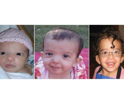 您了解阴道紧缩手术吗？