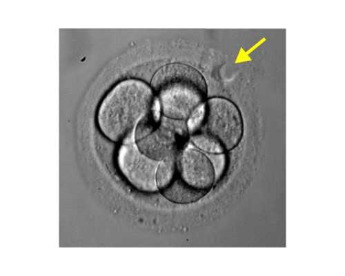 新生儿保险怎么买，新生儿保险哪种好