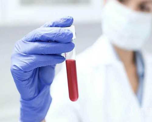 来月经外阴瘙痒怎么回事