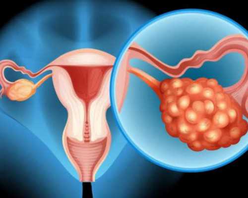 昆明哪个供卵 昆明做试管婴儿多少钱 ‘怀男孩肚型图片是什么样问’