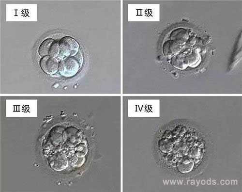 龙游县50岁借卵自怀_龙游县53岁借卵子生子_试管婴儿胚胎等级与成功率有何关系